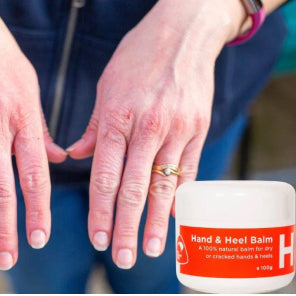 Hand & Heel Balm