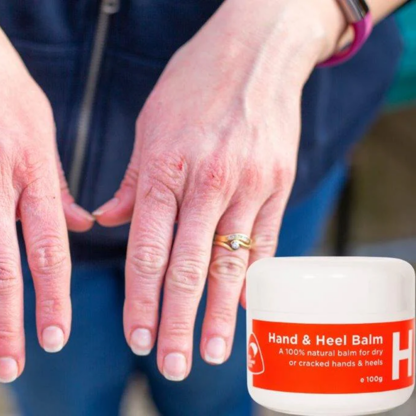 Hand & Heel Balm